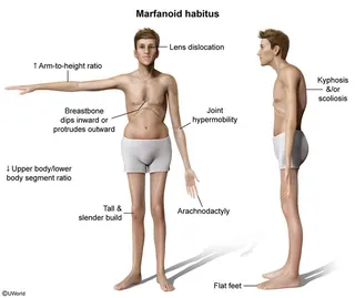 Tall, slender body build with long limbs